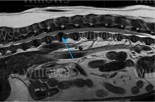 thoracolumbar-disc-disease-scan