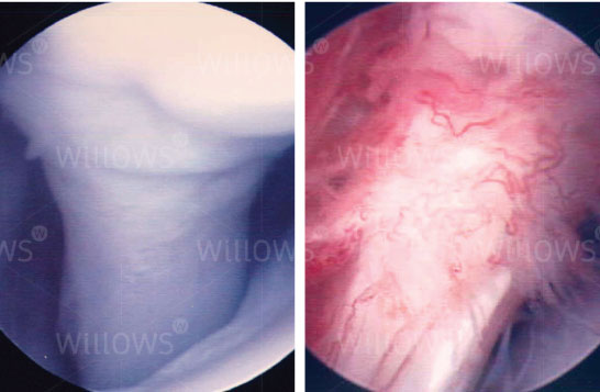 arthroscopy-scan