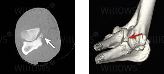 elbow-dysplasia-scan