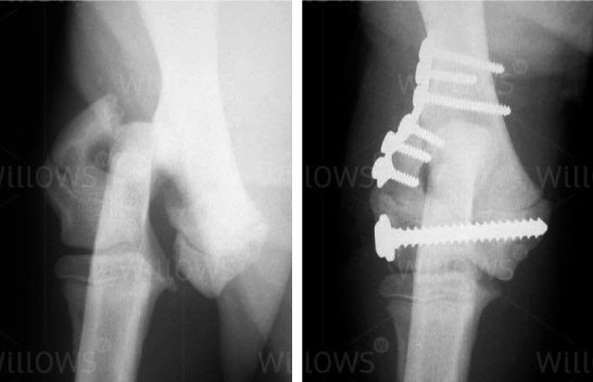 humeral-condylar-scan-with-screws