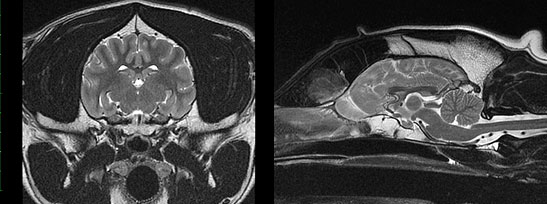 epilepsy-scan