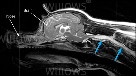 syringomyelia-scan-diagram