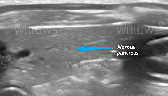 pancreatitis-in-dogs-scan