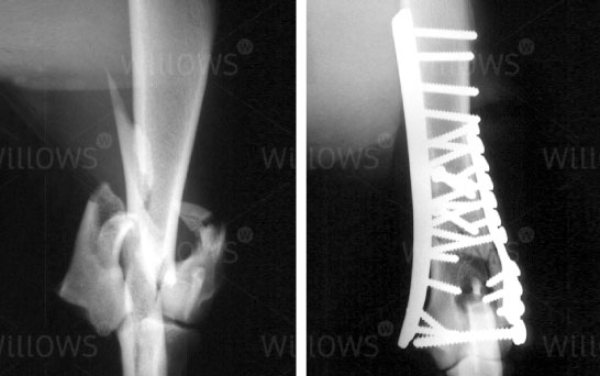 humeral-condylar-scan-with-screws