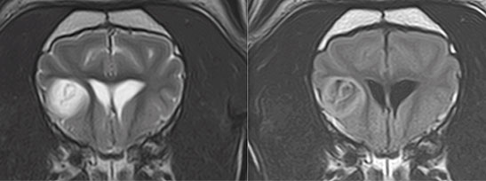 epilepsy-scan