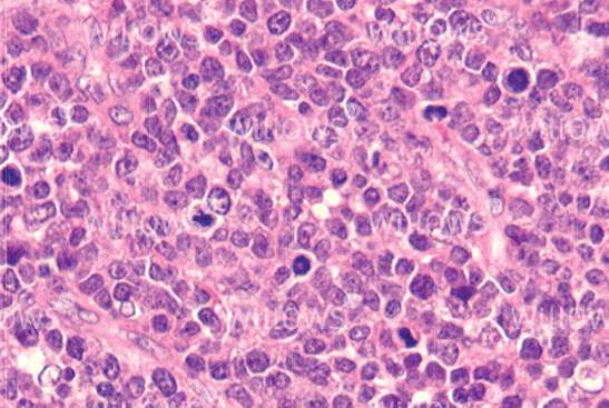 lymphoma-in-dogs-close-up
