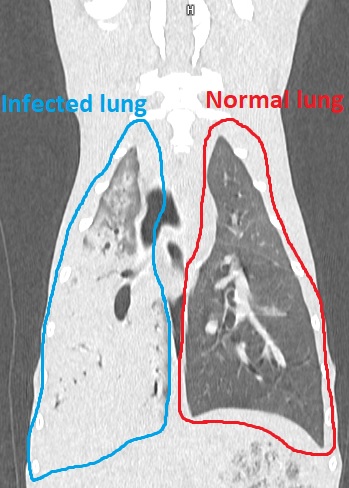 A CT scan of a cocker spaniel's lungs. The left hand lung has been labelled as infected whilst the right hand lung is labelled normal.