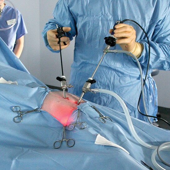 laparoscopic-ovariectomy-operation