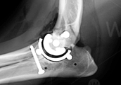 total-elbow-replacement-surgery-scan