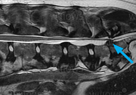 lumbosacral-disease-scan