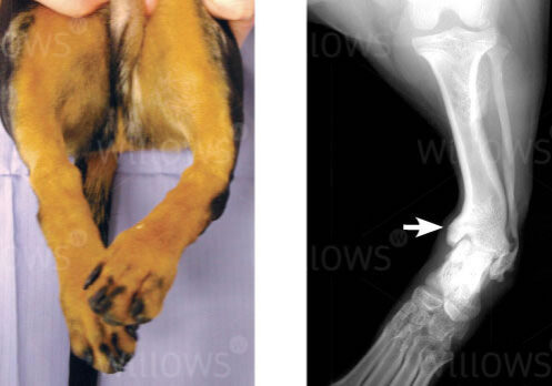 limb-deformity-scan-and-recovery