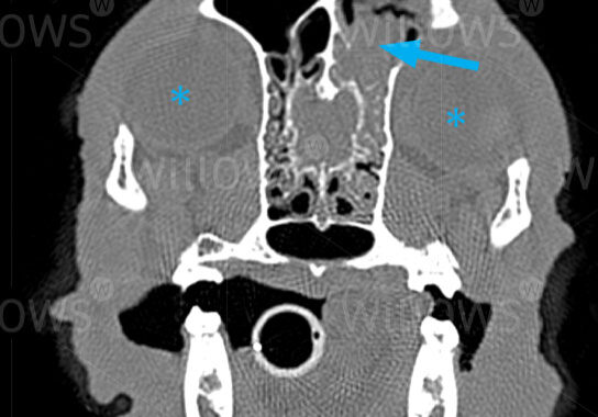 aspergillosis-scan-diagram