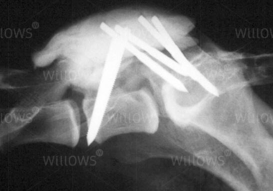 lumbosacral-disease-scan