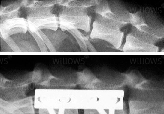 spinal-fracture-scan