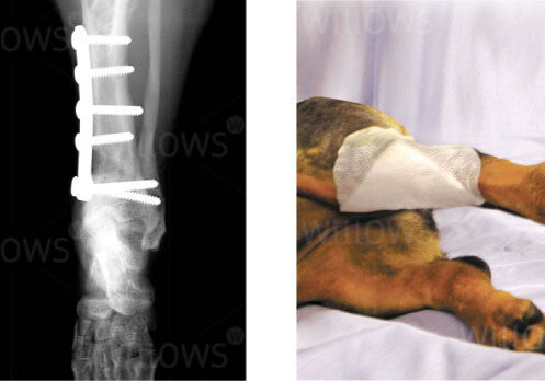 limb-deformity-scan-and-recovery