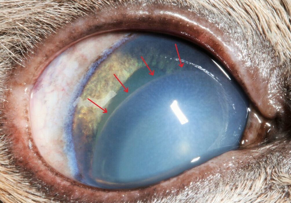 lens-luxation-close-up-eye-diagram