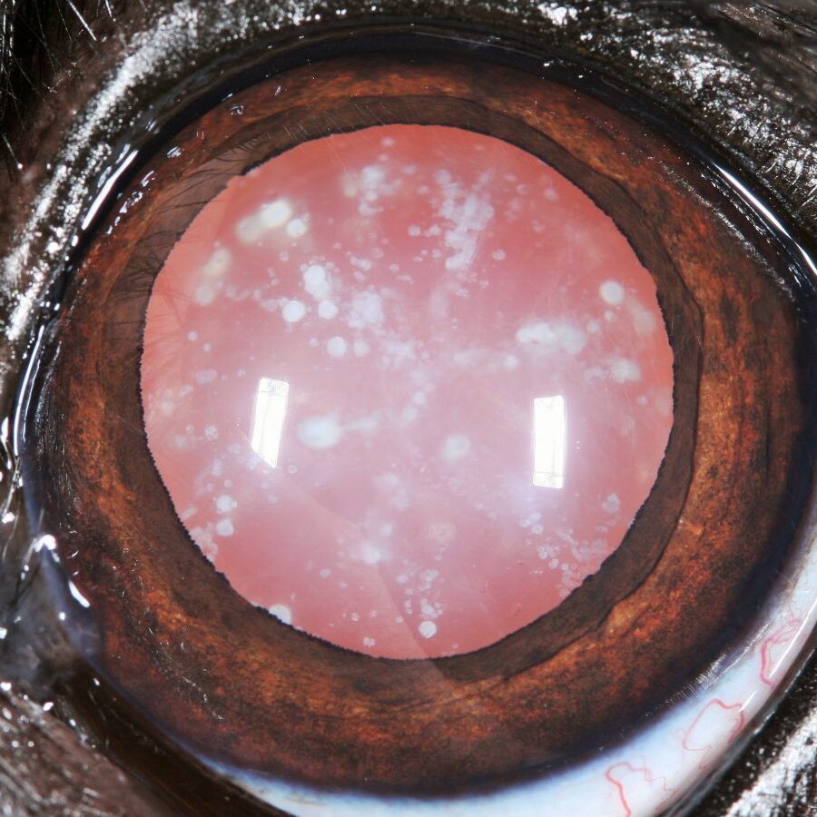 cataracts-close-up-eye