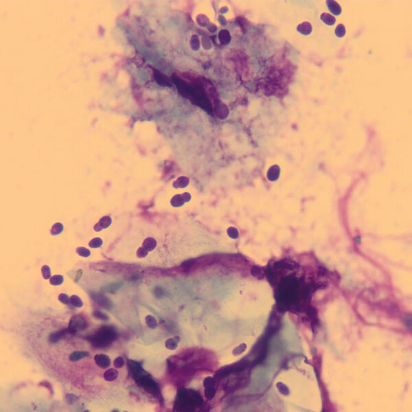 malassezia-dermatitis-cells