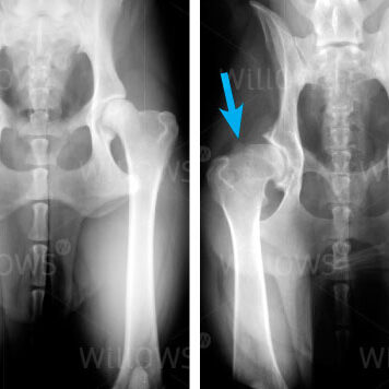osteochondrosis-hip-joints-and-hips-scan